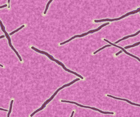 Misteriji: Elektrošok uniči parazite
