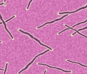 Misteriji: Elektrošok uniči parazite