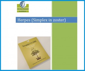 Herpes (simpleks in zoster)